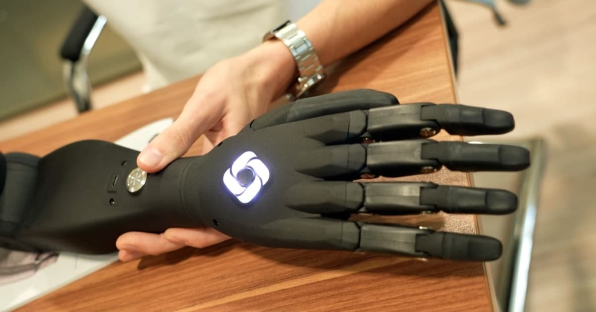 Allbionics виробляє протези для поранених українців — безкоштовно